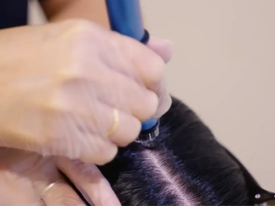 Hydradermabrasion hydrogen scalp therapy for cleansing and hydration