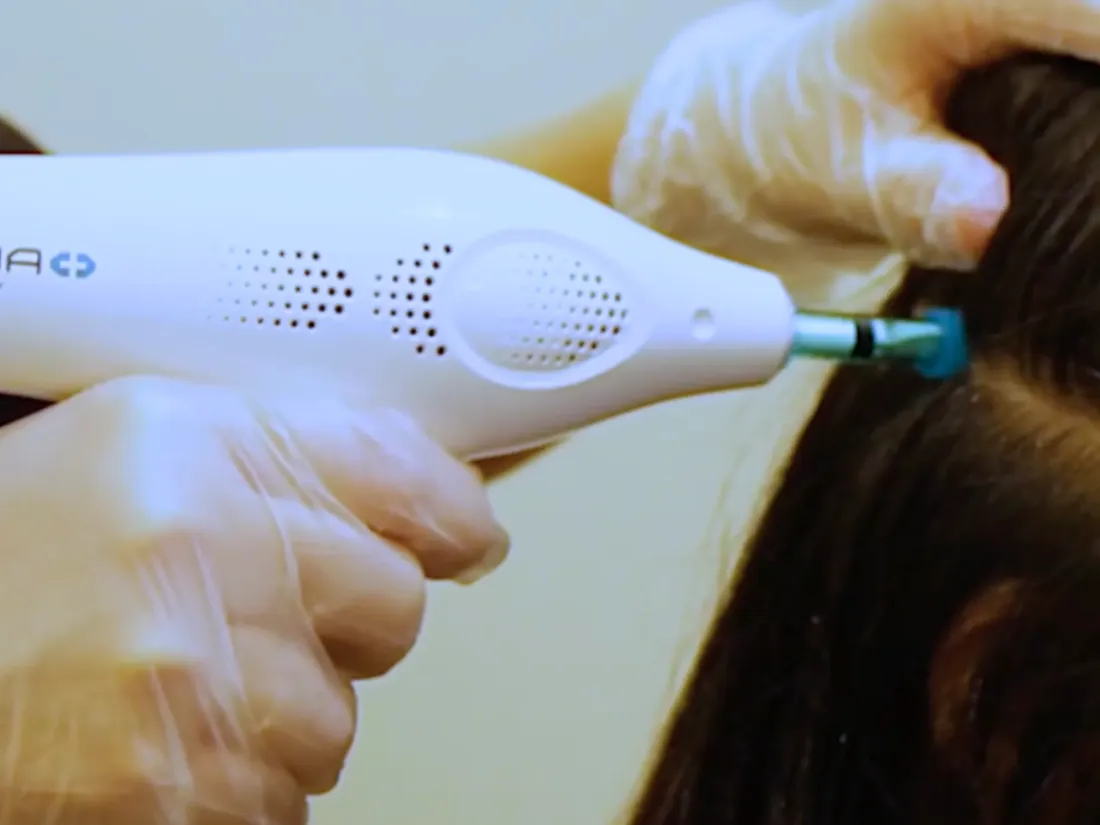 Woman getting a High-Pressure Jet System treatment