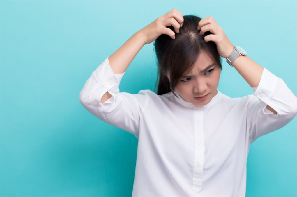 Did You Know that Dandruff can Start in Early Adolescence Itself?