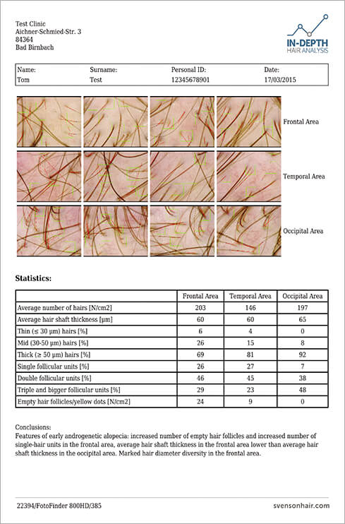 Svenson in depth hair analysis