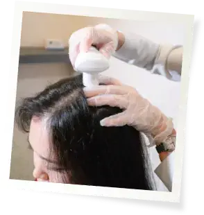 Step 1: Scalp Analysis