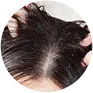 Stressed scalp, dryness or sensitivity