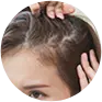 Thinning hair, excessive shedding or slow regrowth