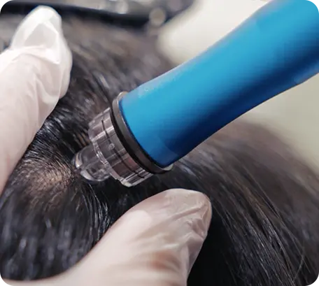 Step 2: Ozone Purification