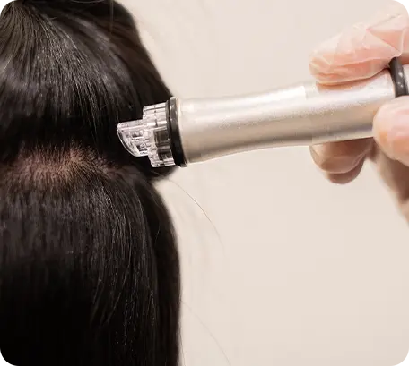 Step 3: Hyaluronic Acid Infusion