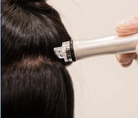 Step 3: Hyaluronic Acid Infusion
